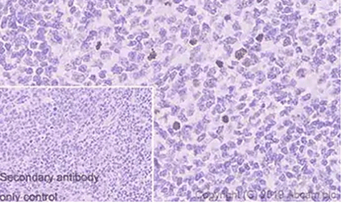 4636. RECOMBINANT ANTI-HISTONE H3 (PHOSPHO S10) ANTIBODY (EPR17246) - CHIP GRADE 100UL - ABCAM