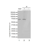 22793. RECOMBINANT ANTI-MMP2 ANTIBODY (EPR17003-25) 100UL ABCAM