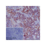 22797. RECOMBINANT ANTI-MERTK ANTIBODY (EPR17534-139) 100UL ABCAM
