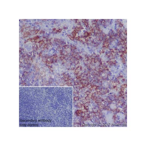 22797. RECOMBINANT ANTI-MERTK ANTIBODY (EPR17534-139) 100UL ABCAM