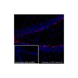 22798. ANTI-DOUBLECORTIN ANTIBODY 50UG ABCAM