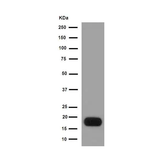 26460. RECOMBINANT ANTI-PROTAMINE 2 ANTIBODY (EPR15738) 100UL ABCAM