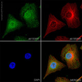 4640. RECOMBINANT ANTI-P38 ANTIBODY (Y122) (ALEXA FLUOR® 488) 100UL - ABCAM