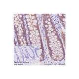22812. RECOMBINANT ANTI-OCCLUDIN ANTIBODY (EPR20992) 100UL ABCAM
