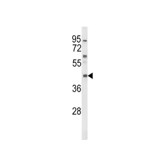 6920. ANTI-MC3-R ANTIBODY 200UL - ABCAM – CTR Scientific