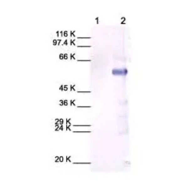 2940. RABBIT POLYCLONAL TO MMP13 100UG - ABCAM