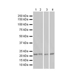 6941. RECOMBINANT ANTI-RAS ANTIBODY (EP1125Y) 100UL - ABCAM