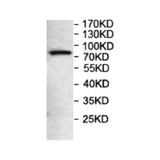 6960. ANTI FOXP2 ANTIBODY 200UL ABCAM
