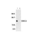 2938. ANTI-CIDE A ANTIBODY 100UG - ABCAM