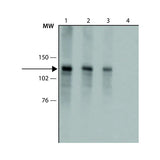2944. COLLAGEN I ANTIBODY 50UL ABCAM