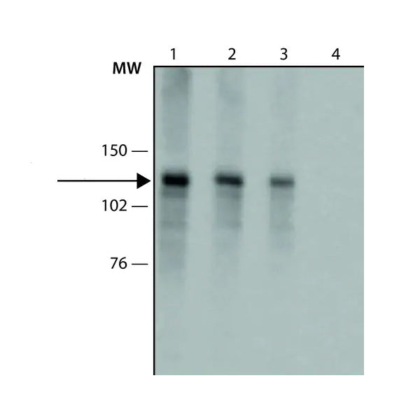 2944. COLLAGEN I ANTIBODY 50UL ABCAM