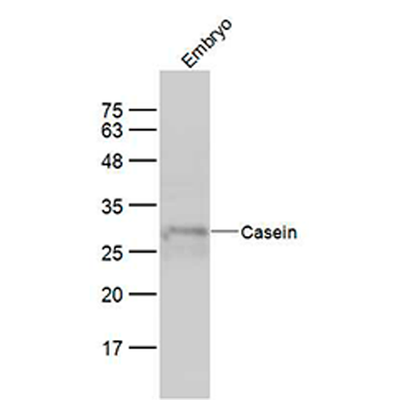 6427. CASEIN POLYCLONAL ANTIBODY 100UL BIOSS ANTIBODIES