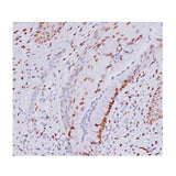 23044. ESTROGEN RECEPTOR (ER) (SP1) 0.5ML BIOCARE MEDICAL