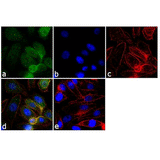 22475. GRK2 MONOCLONAL ANTIBODY (5D5) 100UG INVITROGEN