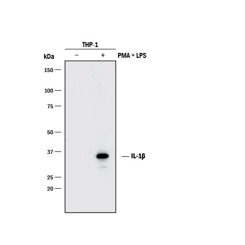 21072. HUMAN IL-1 BETA / IL-1F2 ANTIBODY 25UG - R&D SYSTEMS