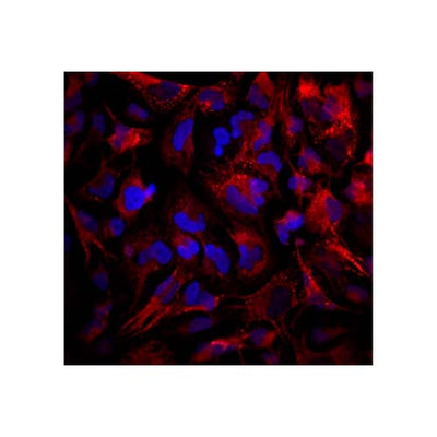 15839. HUMAN COLLAGEN IV ALPHA 1 ANTIBODY 100UG - R&D SYSTEMS