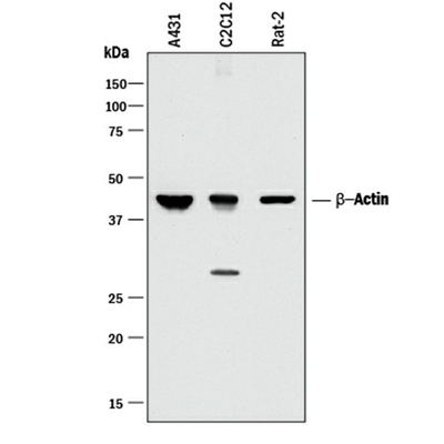 5832. HUMAN/MOUSE/RAT BETA-ACTIN ANTIBODY 100UG - R&D SYSTEMS
