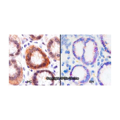 21702. RABBIT POLYCLONAL XCT ANTIBODY 0.1ML - NOVUS BIOLOGICALS