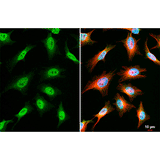 22474. OGT POLYCLONAL ANTIBODY 100UL INVITROGEN