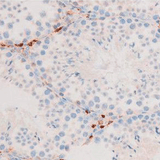 26890. HOSPHO-SMAD2/SMAD3 (THR8) POLYCLONAL ANTIBODY 100UL INVITROGEN