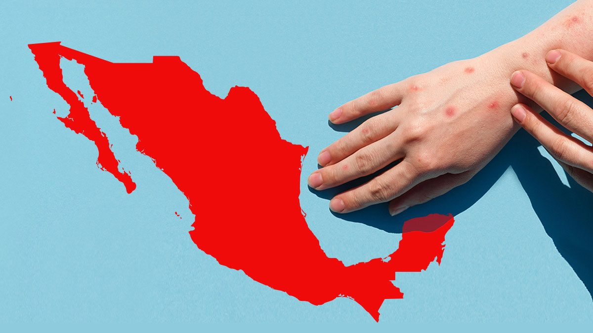 México enfrenta brote de sarampión con estrategia preventiva y vacunación intensiva