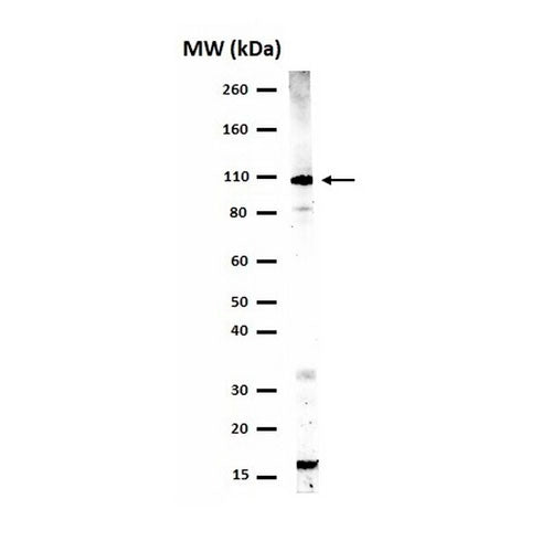 51205. ANTI-PHOSPHO-STAT2 (TYR689) ANTIBODY CLONE FROM RABBIT 200UL - UPSTATE