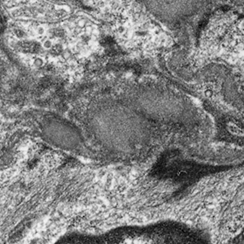 24792. MEDIO DE INCLUSION LR WHITE P/MICROSCOPIA DE LUZ, ELECTRONICA DE RUTINA, HISTOQUIMICA E INMUNOHISTOQUIMICA 500GR POLYSCIENCES