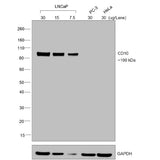 31067. CHICKEN ANTI-GOAT IGG (H+L) SECONDARY ANTIBODY BIOTIN 1MG INVITROGEN