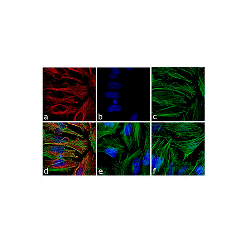 4386. DONKEY ANTI-MOUSE IGG (H+L) HIGHLY CROSS ADSORBED ANTIBODY ALEXA FLUOR 555, 1MG - INVITROGEN