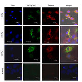 52071. IGG (H+L) HIGHLY CROSS-ADSORBED GOAT ANTI-MOUSE ALEXA FLUOR PLUS 647 SECONDARY ANTIBODY 100UG - INVITROGEN