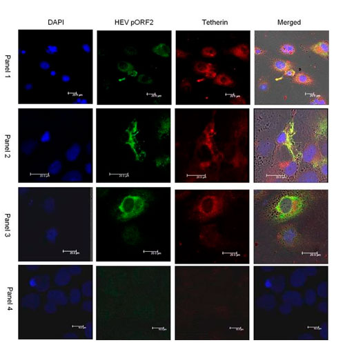 52071. IGG (H+L) HIGHLY CROSS-ADSORBED GOAT ANTI-MOUSE ALEXA FLUOR PLUS 647 SECONDARY ANTIBODY 100UG - INVITROGEN