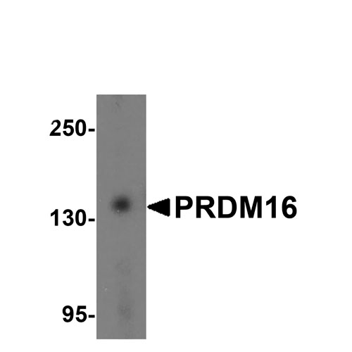 23846. ANTI-PRDM16 ANTIBODY 100UG ABCAM – CTR Scientific