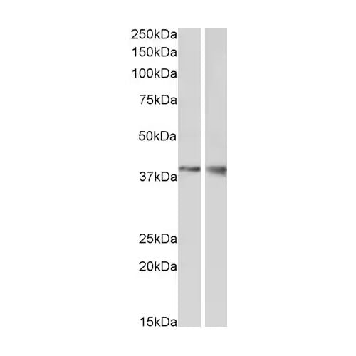 29195. ANTI-WNT9B ANTIBODY 100UG ABCAM