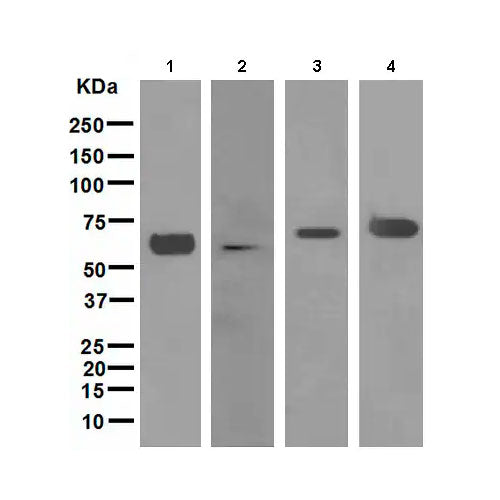 28766. RECOMBINANT ANTI-ALPHA INTERNEXIN ANTIBODY (EPR1529) 100UL ABCAM