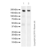 29427. RECOMBINANT ANTI-CALBINDIN ANTIBODY (EP3478) 100UL ABCAM