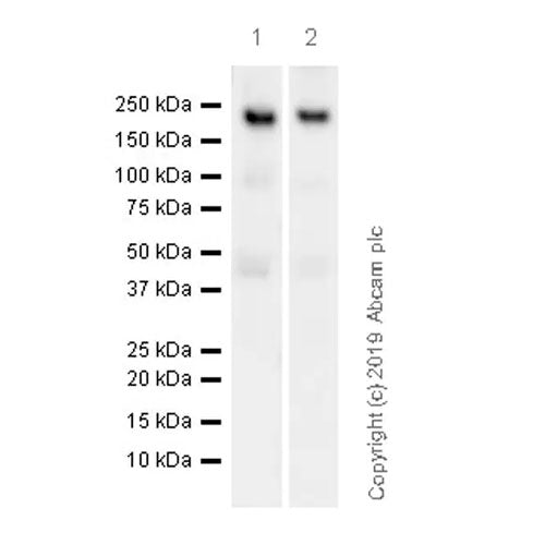 29427. RECOMBINANT ANTI-CALBINDIN ANTIBODY (EP3478) 100UL ABCAM