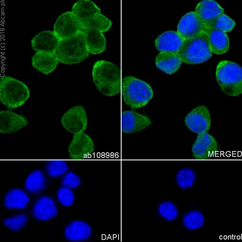 27984. RECOMBINANT ANTI-PGP9.5 ANTIBODY (EPR4118) - NEURONAL MARKER 100UL ABCAM