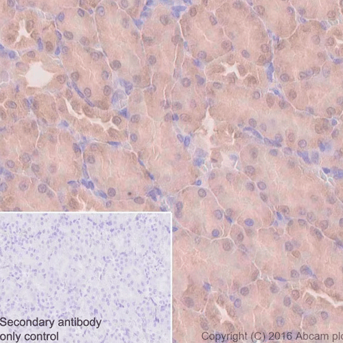 27985. RECOMBINANT ANTI-UFM1 ANTIBODY (EPR4264(2)) 100UL ABCAM