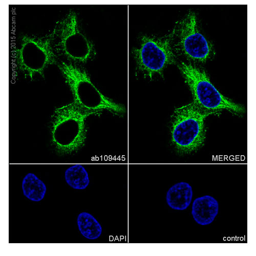 29914. RECOMBINANT ANTI-DESMOPLAKIN ANTIBODY (EPR4383(2)) 100UL ABCAM