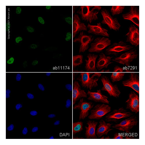 29431. ANTI-GAMMA H2A.X (PHOSPHO S139) ANTIBODY 50UG ABCAM