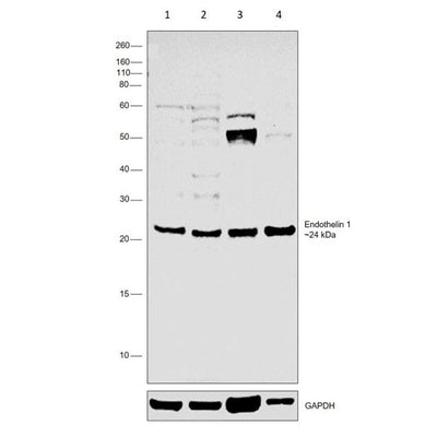 29855. ANTI-ENDOTHELIN 1 ANTIBODY 100UL ABCAM
