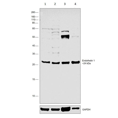 29855. ANTI-ENDOTHELIN 1 ANTIBODY 100UL ABCAM