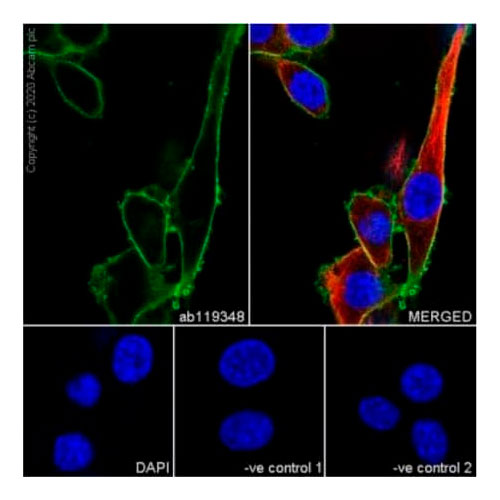 29909. RECOMBINANT ANTI-CD44 ANTIBODY (1M7.8.1) 100UG ABCAM