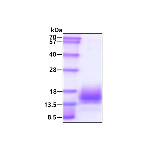 27993. RECOMBINANT MYCOBACTERIUM TUBERCULOSIS ESAT6 PROTEIN 50UG ABCAM