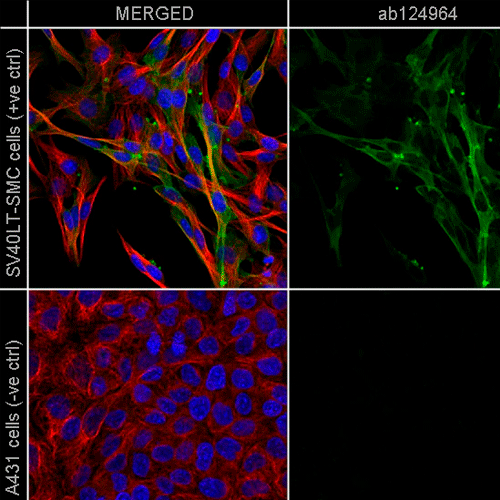 27994. RECOMBINANT ANTI-ALPHA SMOOTH MUSCLE ACTIN ANTIBODY (EPR5368), 100UL ABCAM