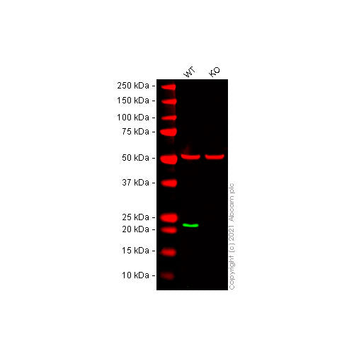 29437. RECOMBINANT ANTI-RAB7 ANTIBODY (EPR7588(B))-LATE ENDOSOME MARKER 100UL ABCAM