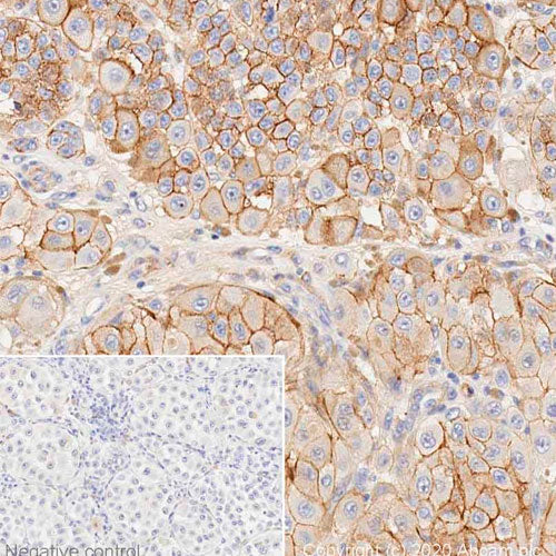 29185. ANTI-NG2 ANTIBODY 100UG ABCAM