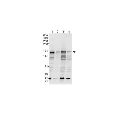 29902. ANTI-P GLYCOPROTEIN ANTIBODY 100UG ABCAM