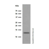 28776. RECOMBINANT ANTI-CYTOCHROME C ANTIBODY (EPR1327) 100UL ABCAM