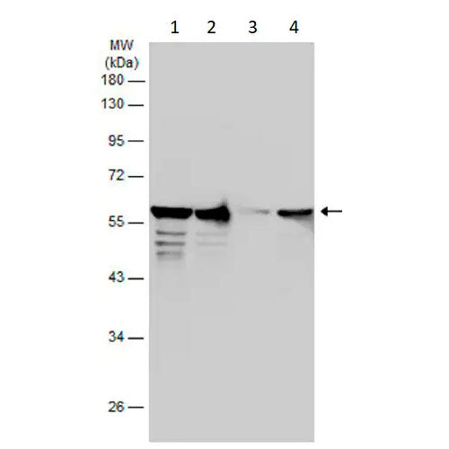 29193. ANTI-VIMENTIN ANTIBODY 50UL ABCAM